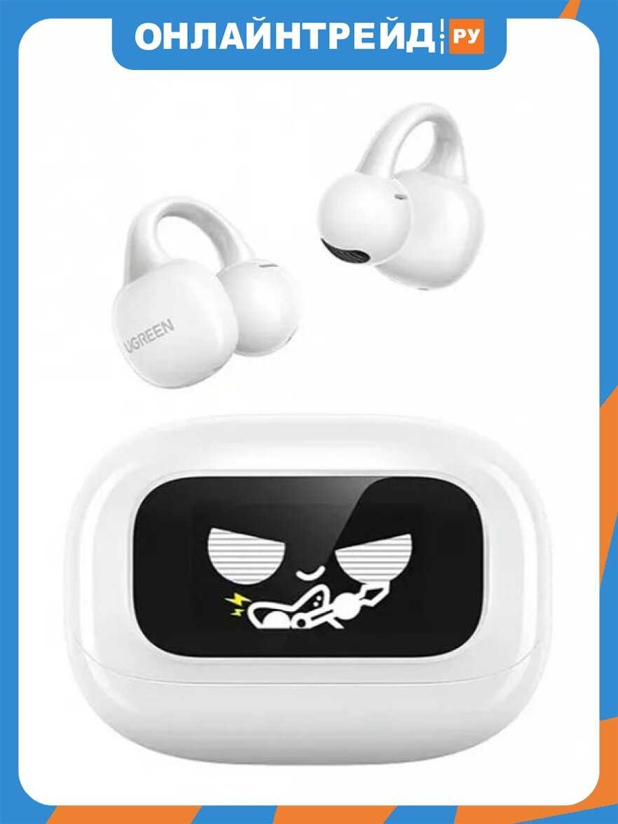 UGreen HiTune S6