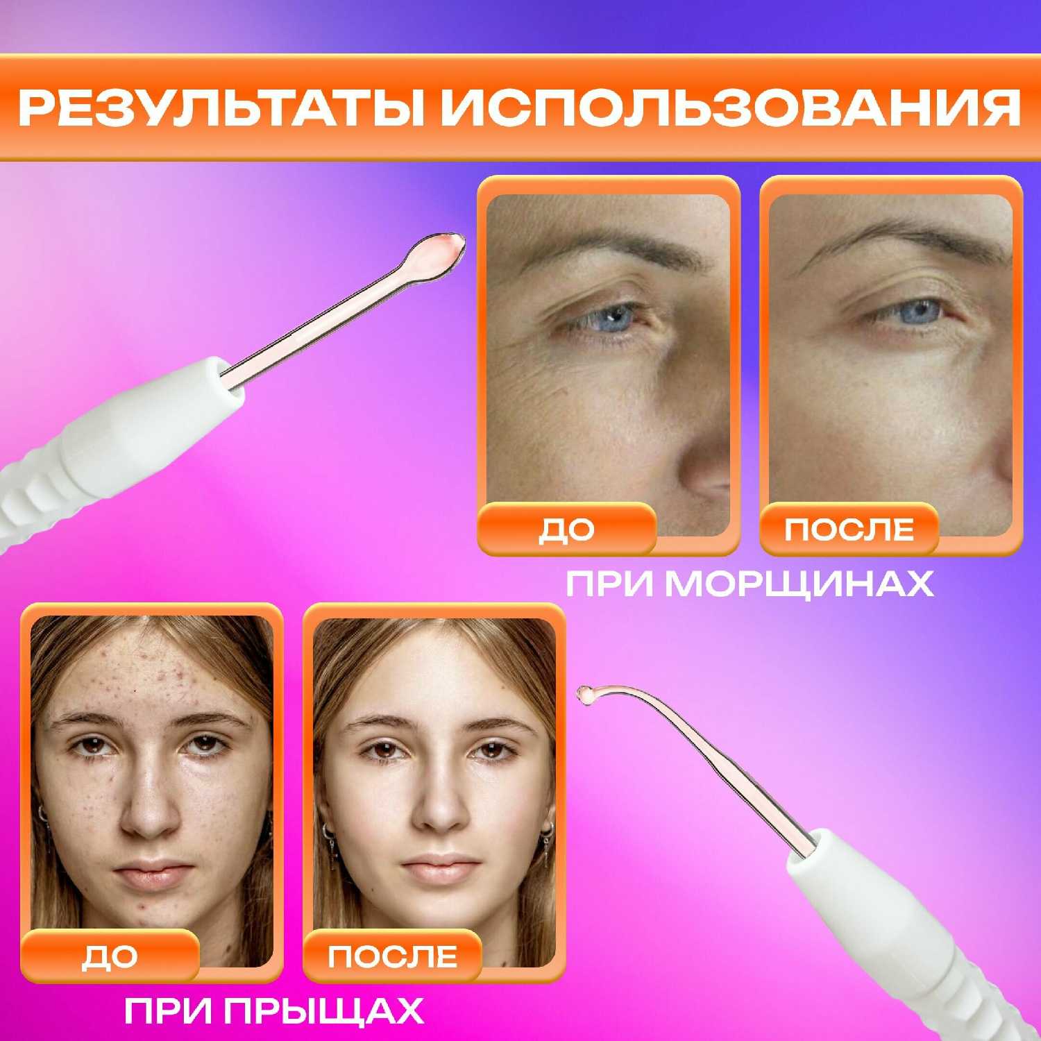 Дарсонваль Dr.Skin Care профессиональный аппарат для волос лица и тела фотография 7