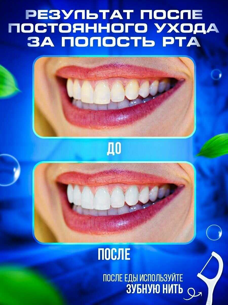Насадки на щетку Oral-B Насадки на щетку (набор 4 шт) фотография 4