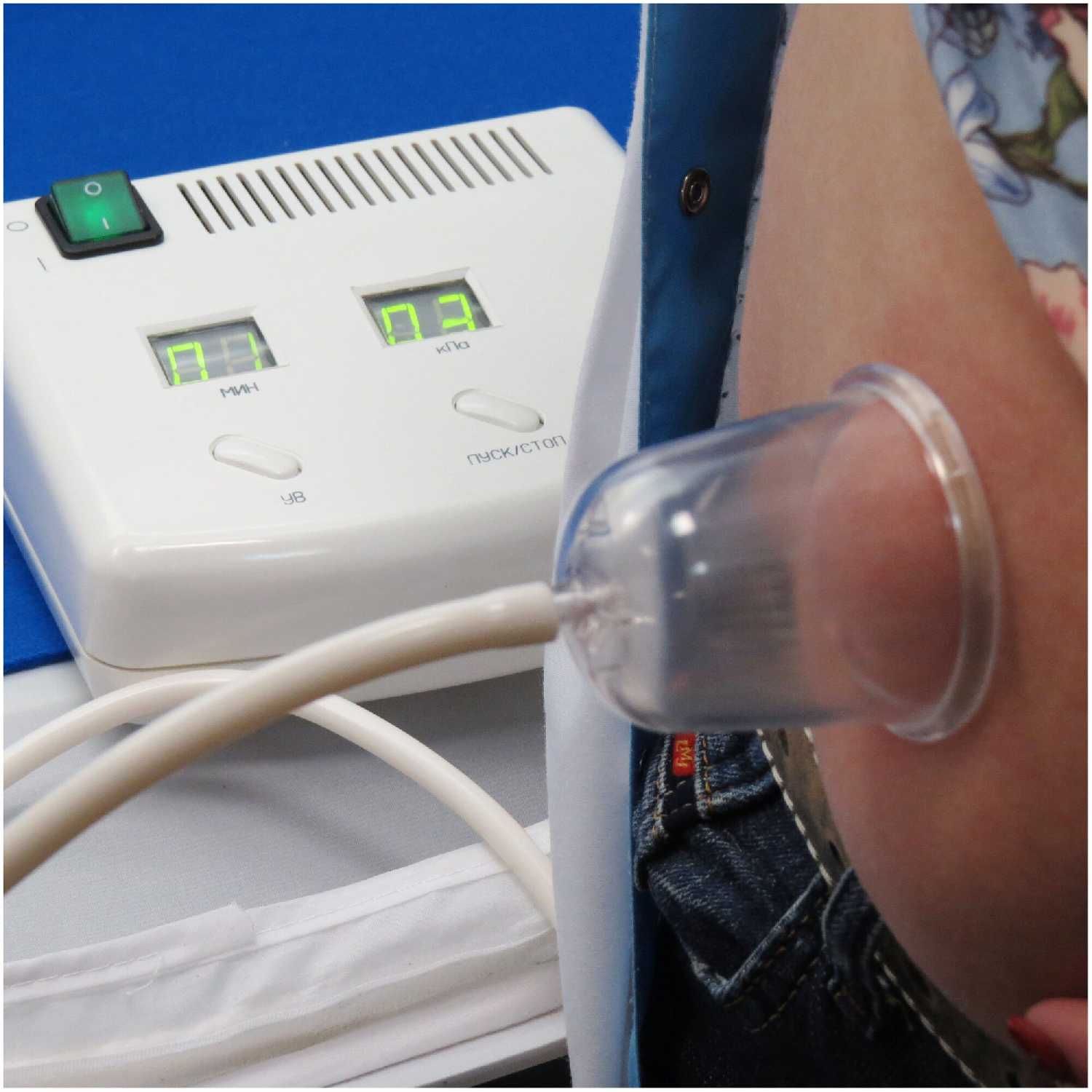 Вакуумный массажер Микро-В (ВМ-50-01) фотография 3