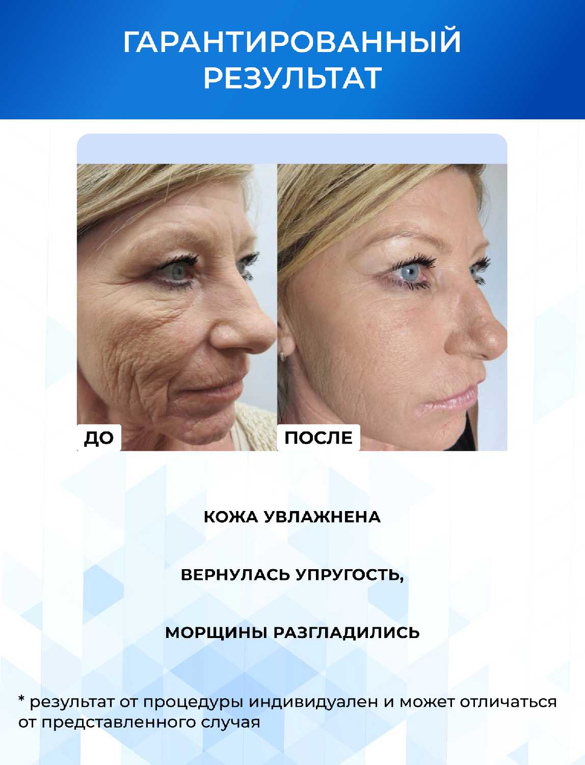 Дермапен Dr.pen A11