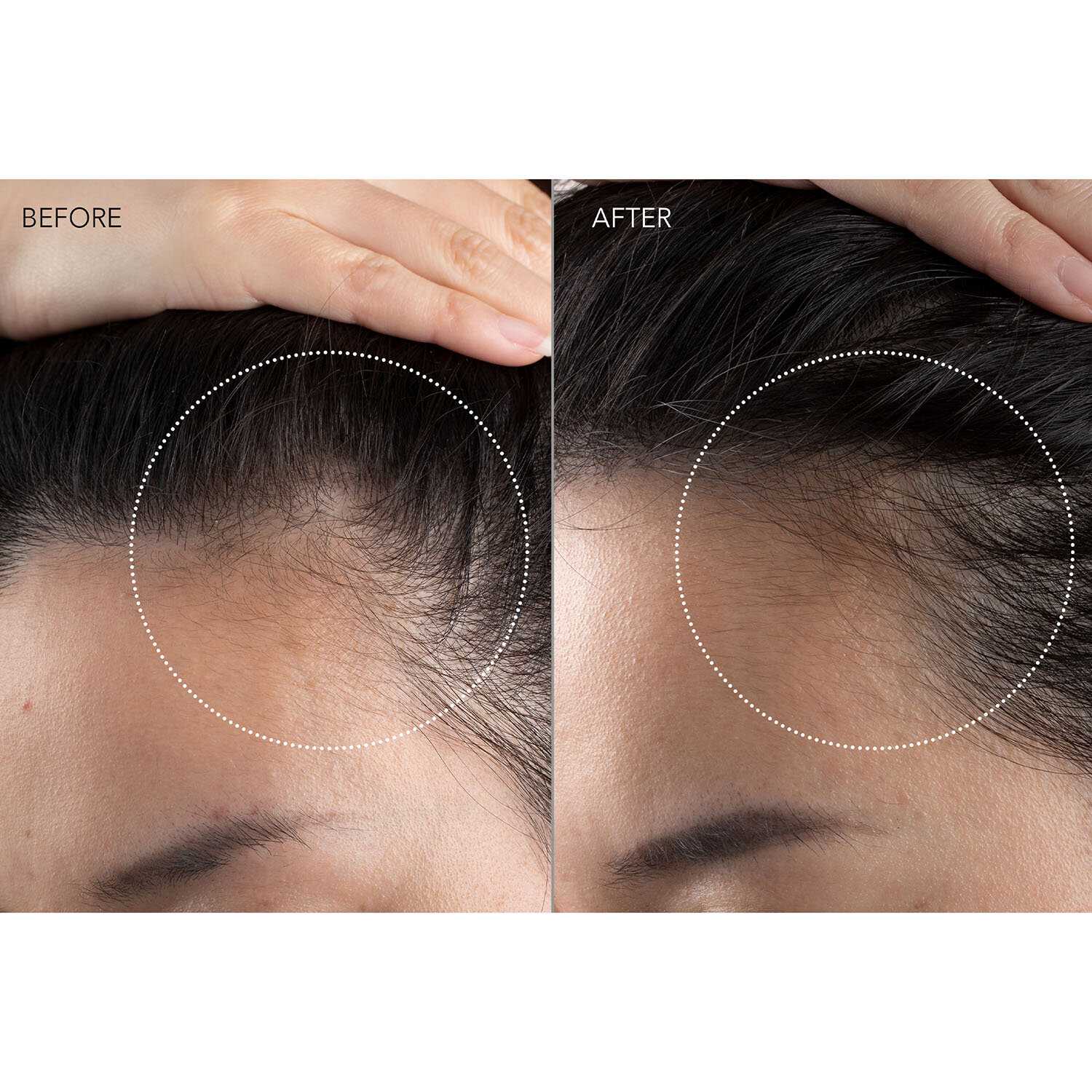 FAQ LED-массажер для головы (301) фотография 8