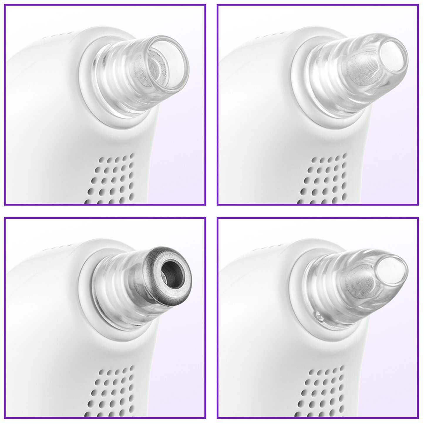 Вакуумный очиститель кожи Kitfort КТ-3126 фотография 1