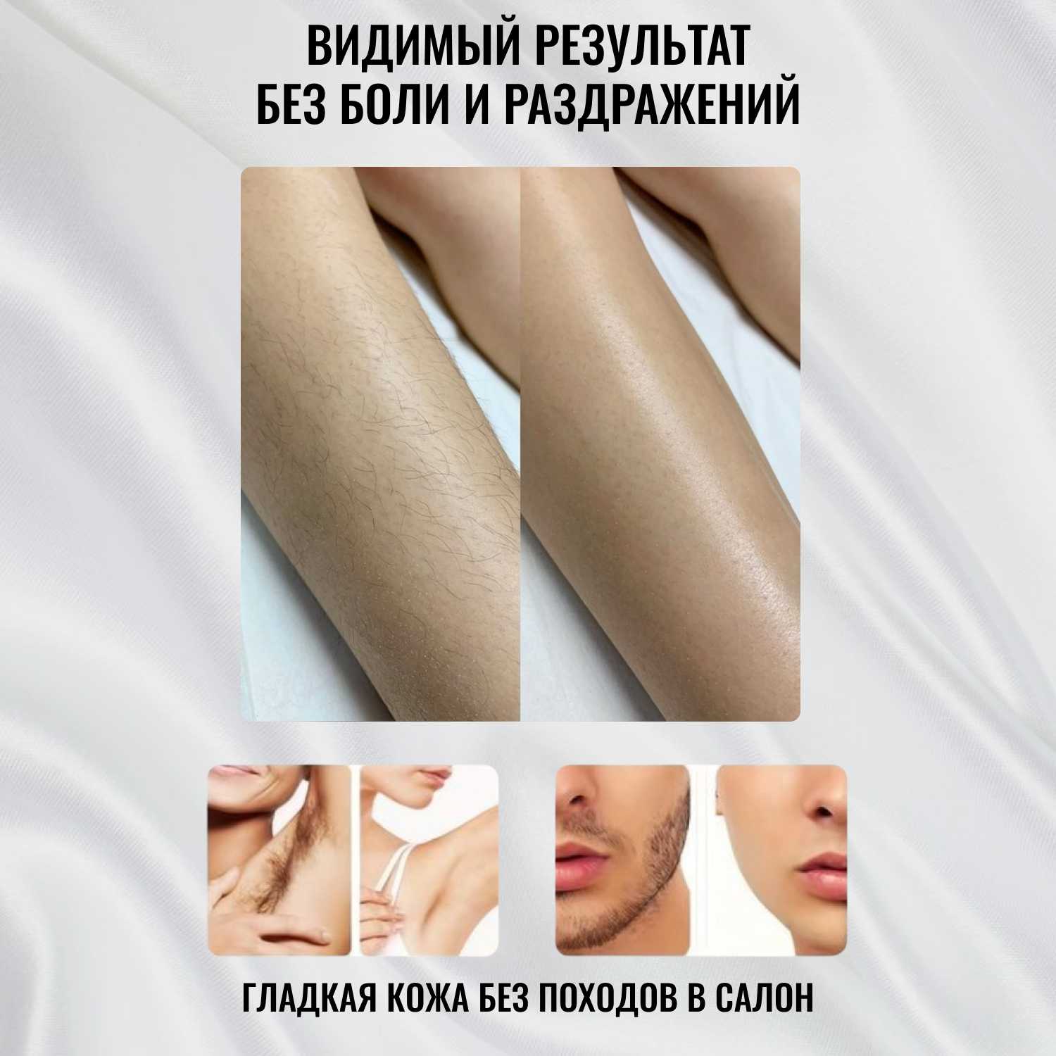 Профессиональный фотоэпилятор Gecht IPL (999 999) фотография 7