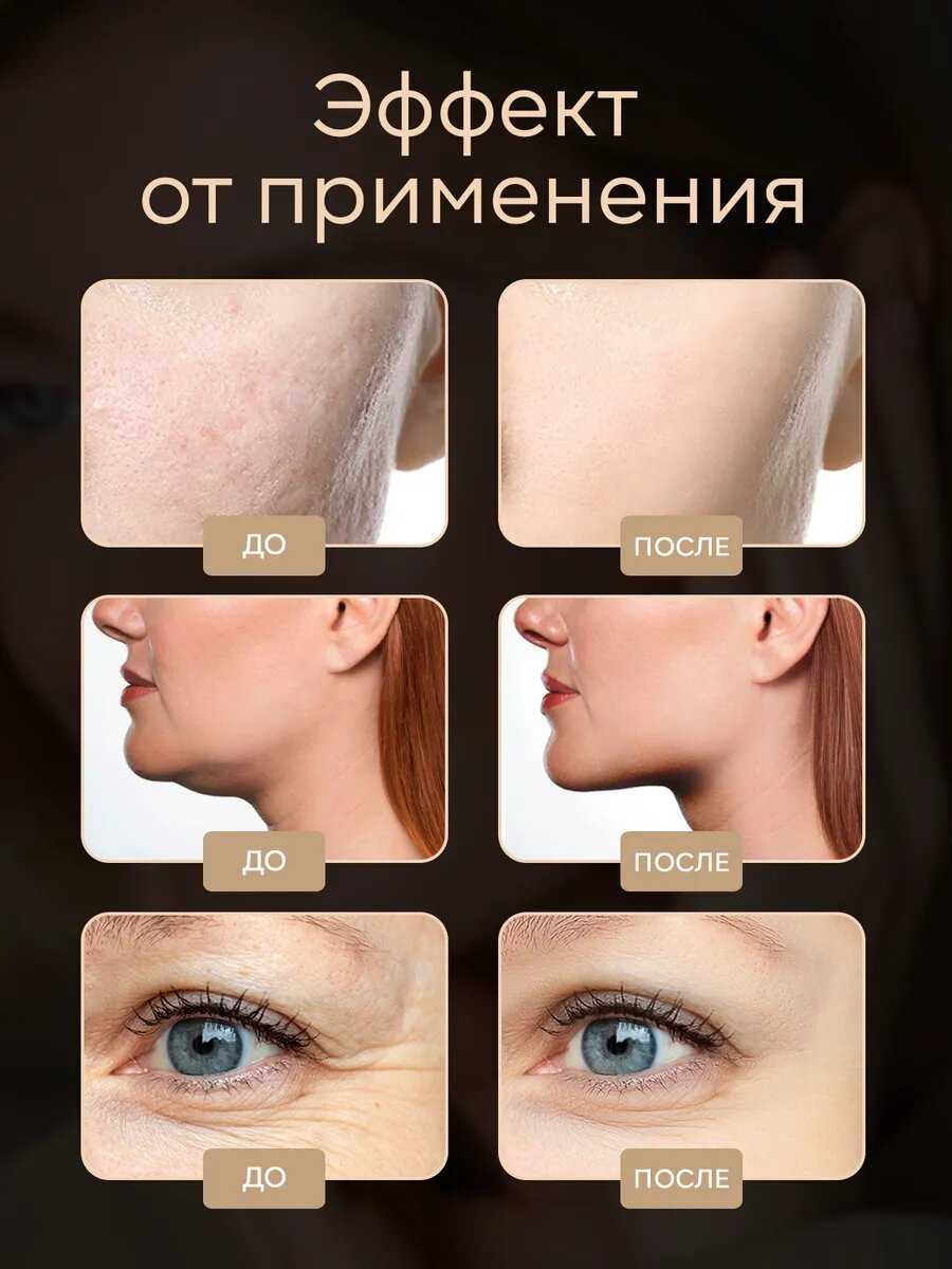 Массажеры для лица Asia Care Микротоковый роликовый массажер для лица [] фотография 7