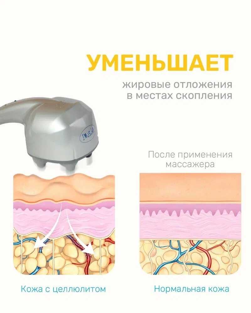 Массажер медицинский Nozomi MH-102 фотография 20