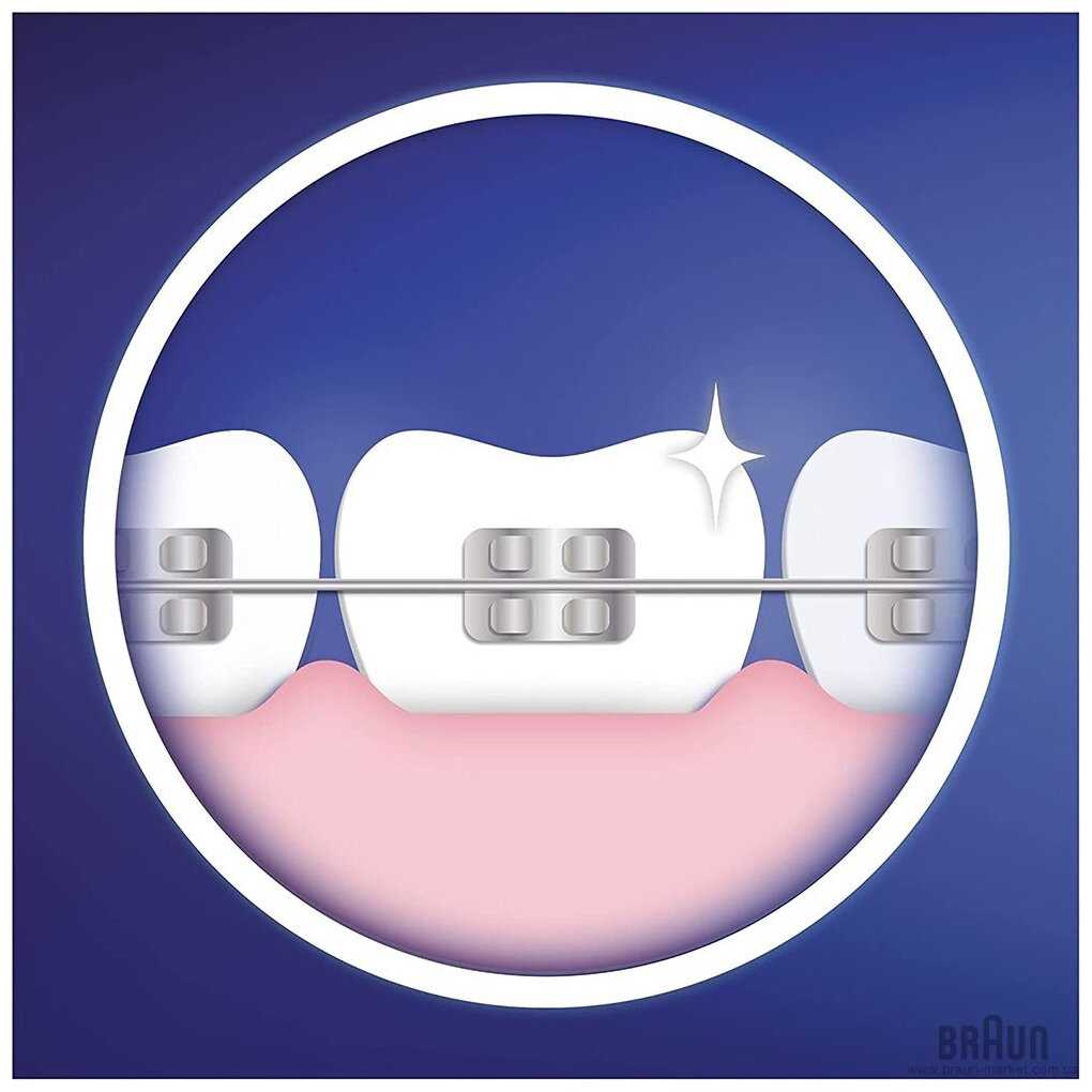Насадка Oral-B Ortho Care Essentials (IP17-3) фотография 9