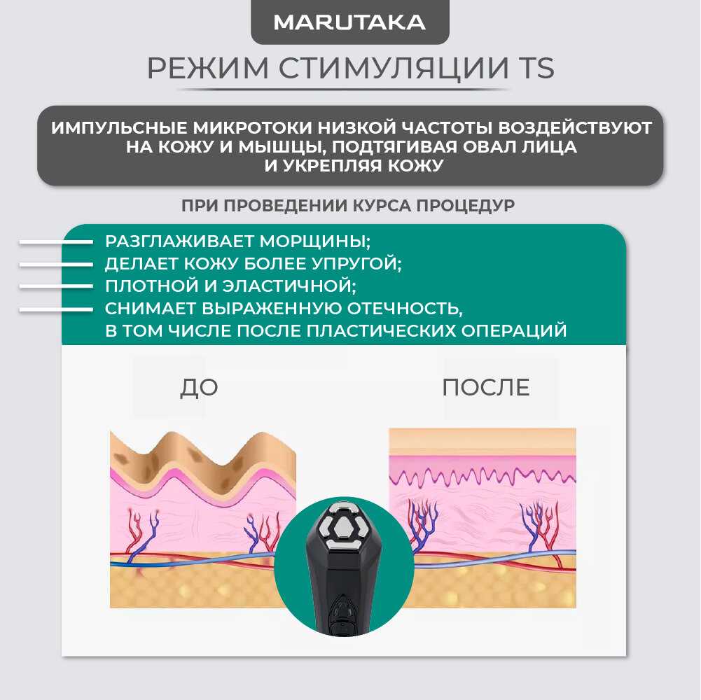 Аппарат для SMAS-лифтинга MARUTAKA LUXE фотография 1