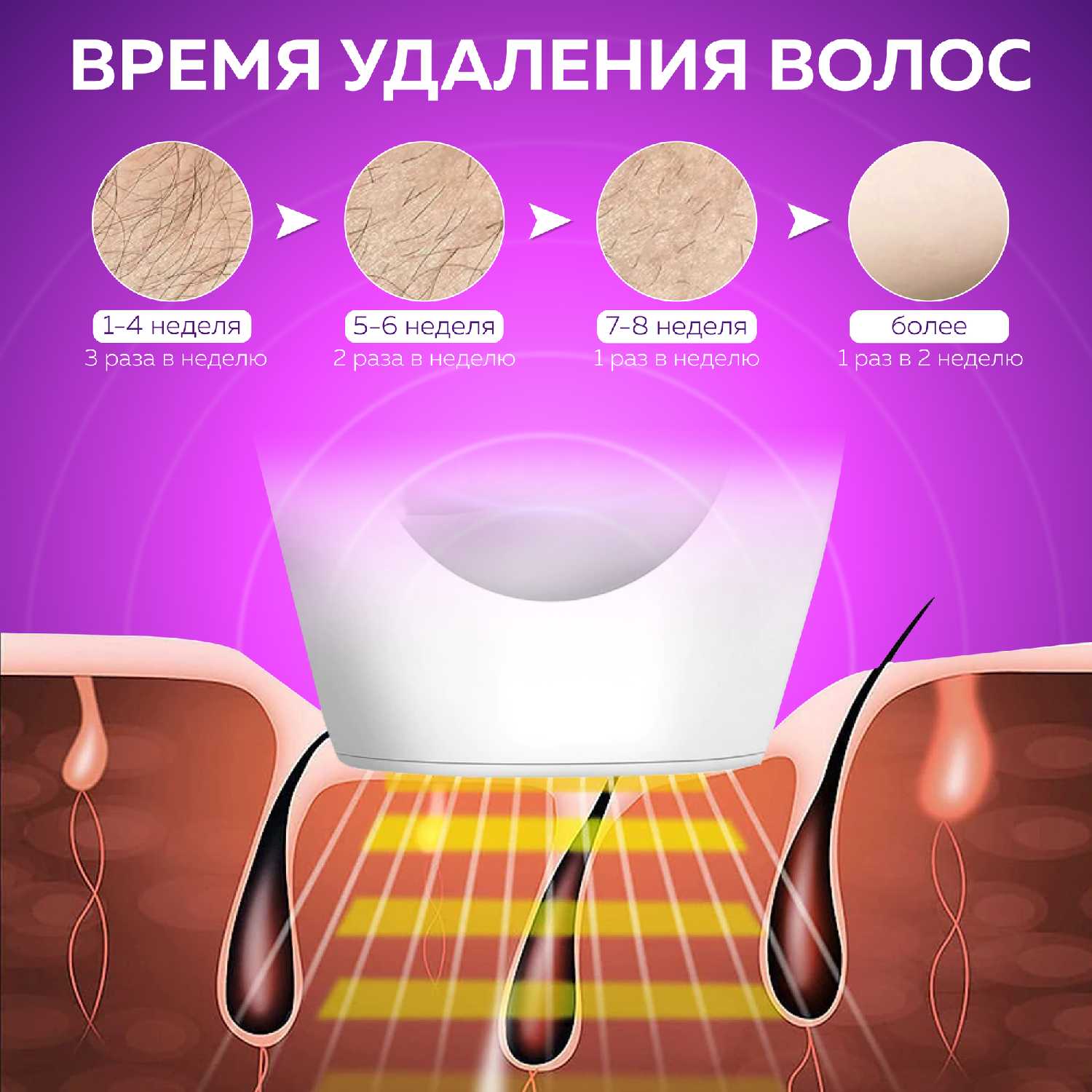 Фотоэпилятор фотография 14