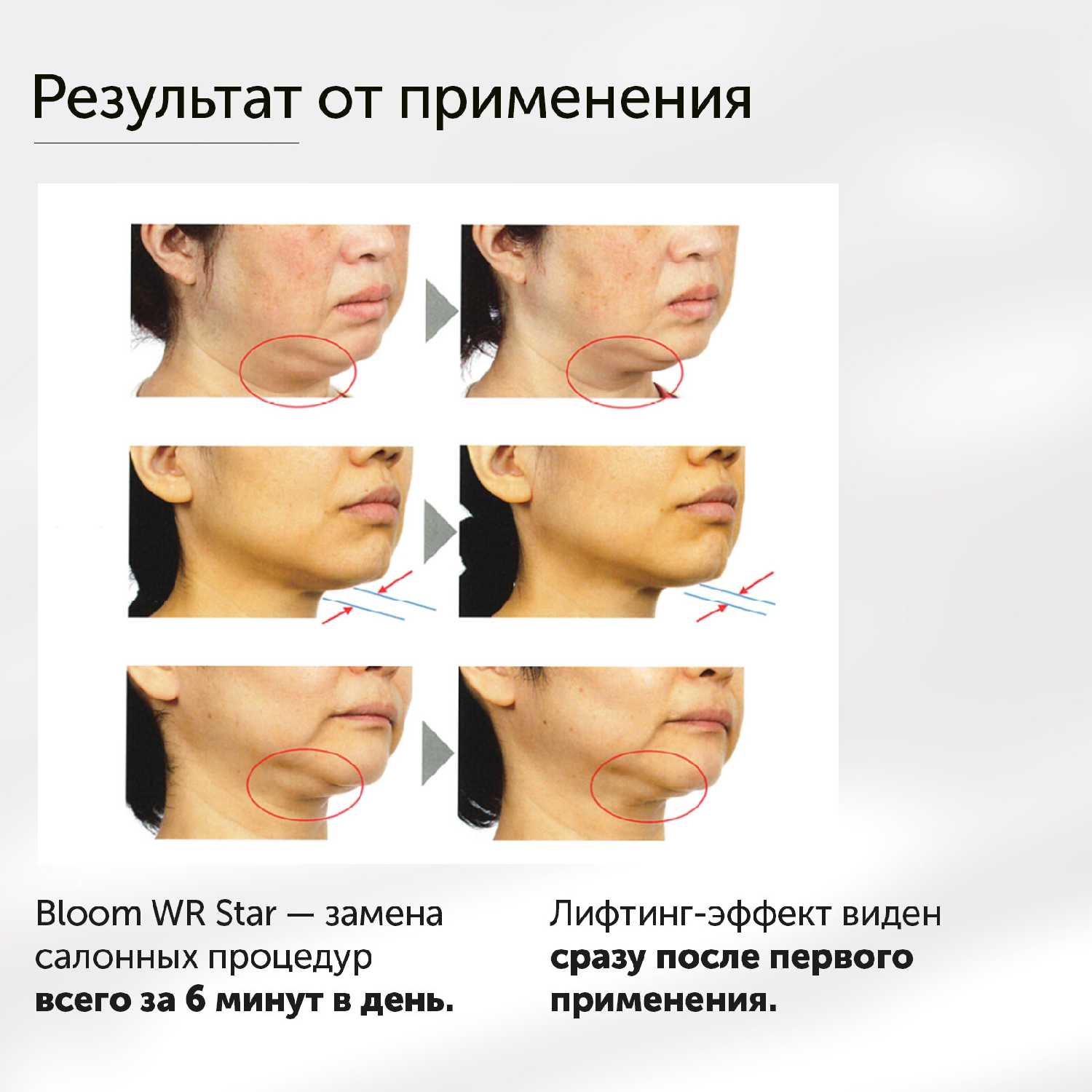 Косметологический аппарат для лица YA-MAN Photo PLUS фотография 4