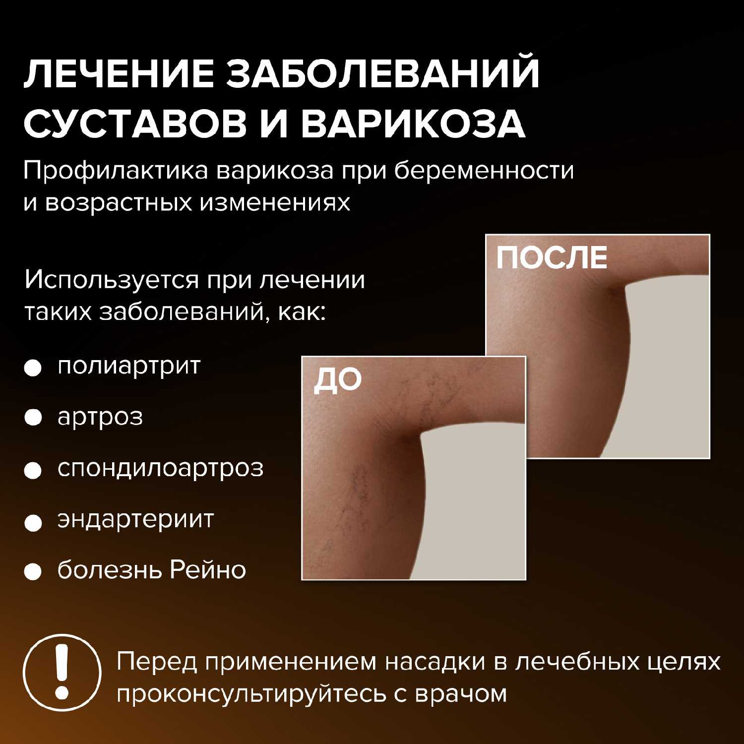 Аппарат дарсонваль HoneyCare для волос, для лица и тела с 5 насадками фотография 2