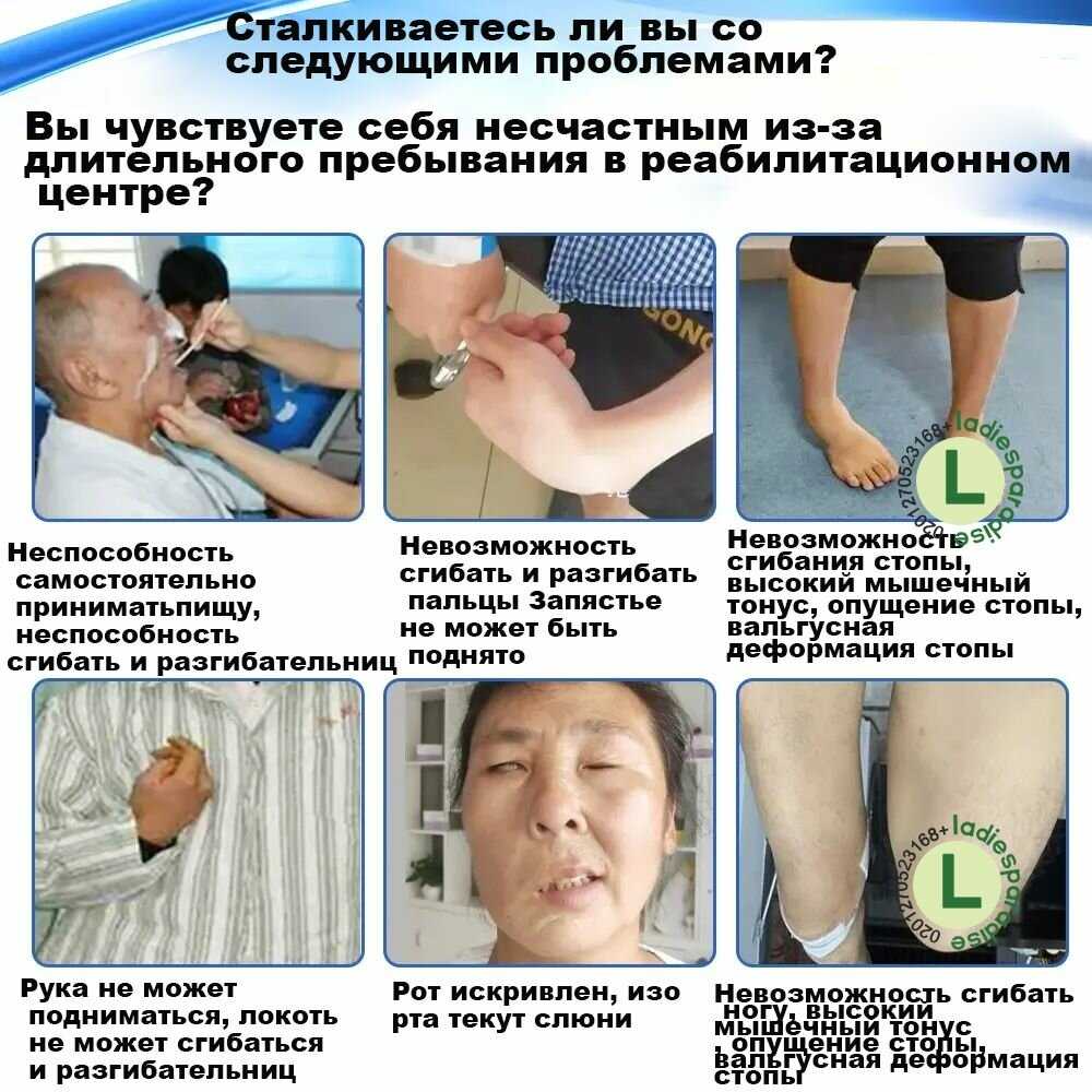 Электроиглоукалывание Устройство для стимуляции мышц с 6 каналами фотография 18