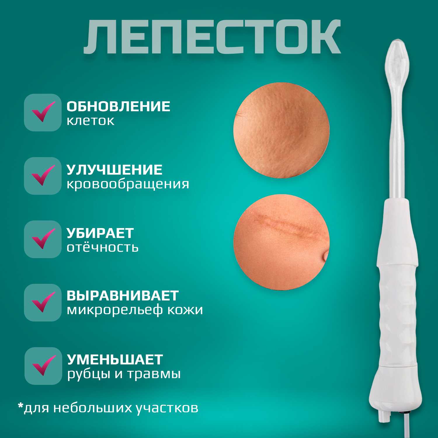 Дарсонваль медицинский Дарсонваль (профессиональный аппарат с насадками) фотография 5
