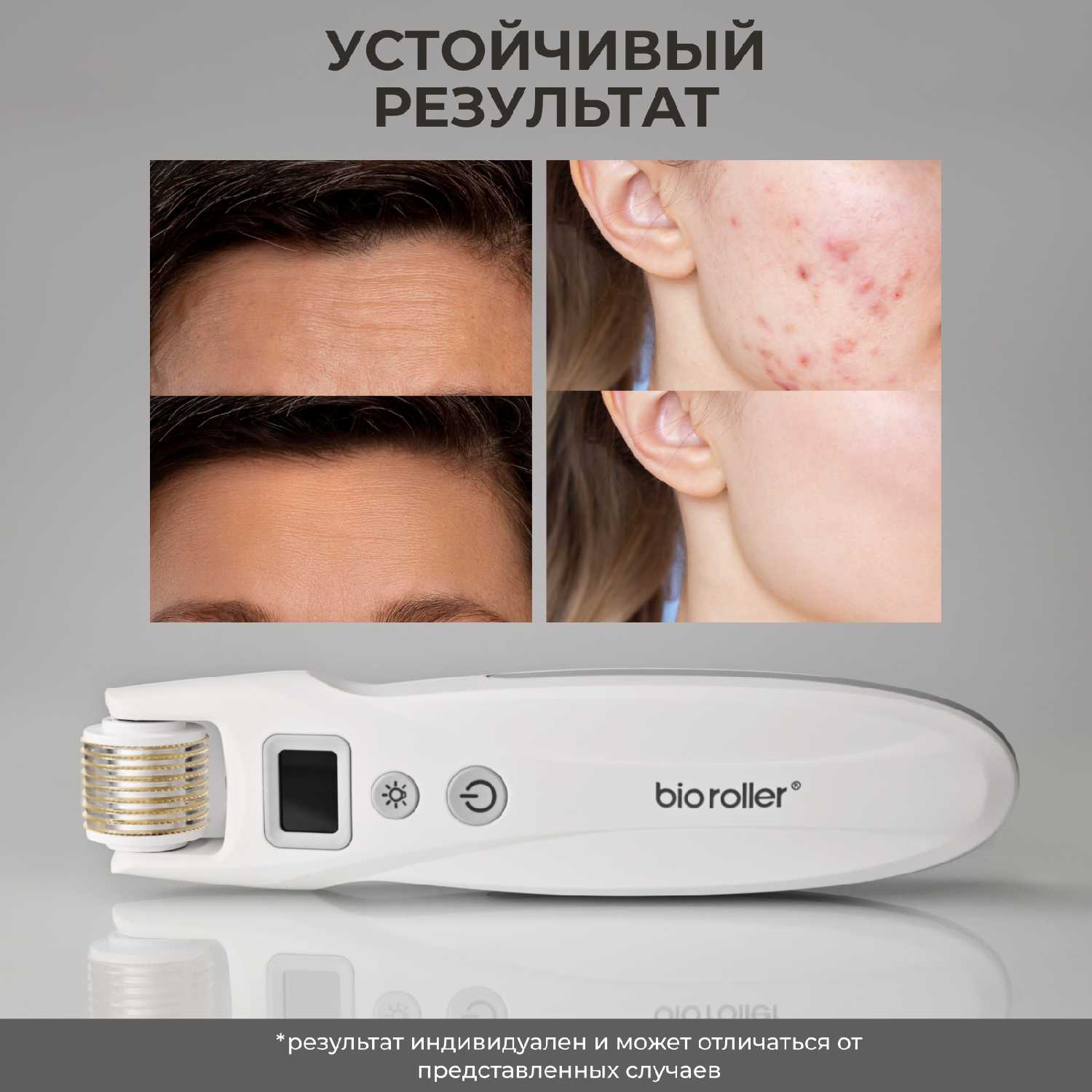 Mezonica Bio Roller G5 фотография 10