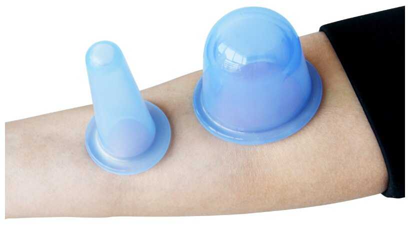 Массажёр ONLITOP Вакуумные банки для массажа (7663019) фотография 3