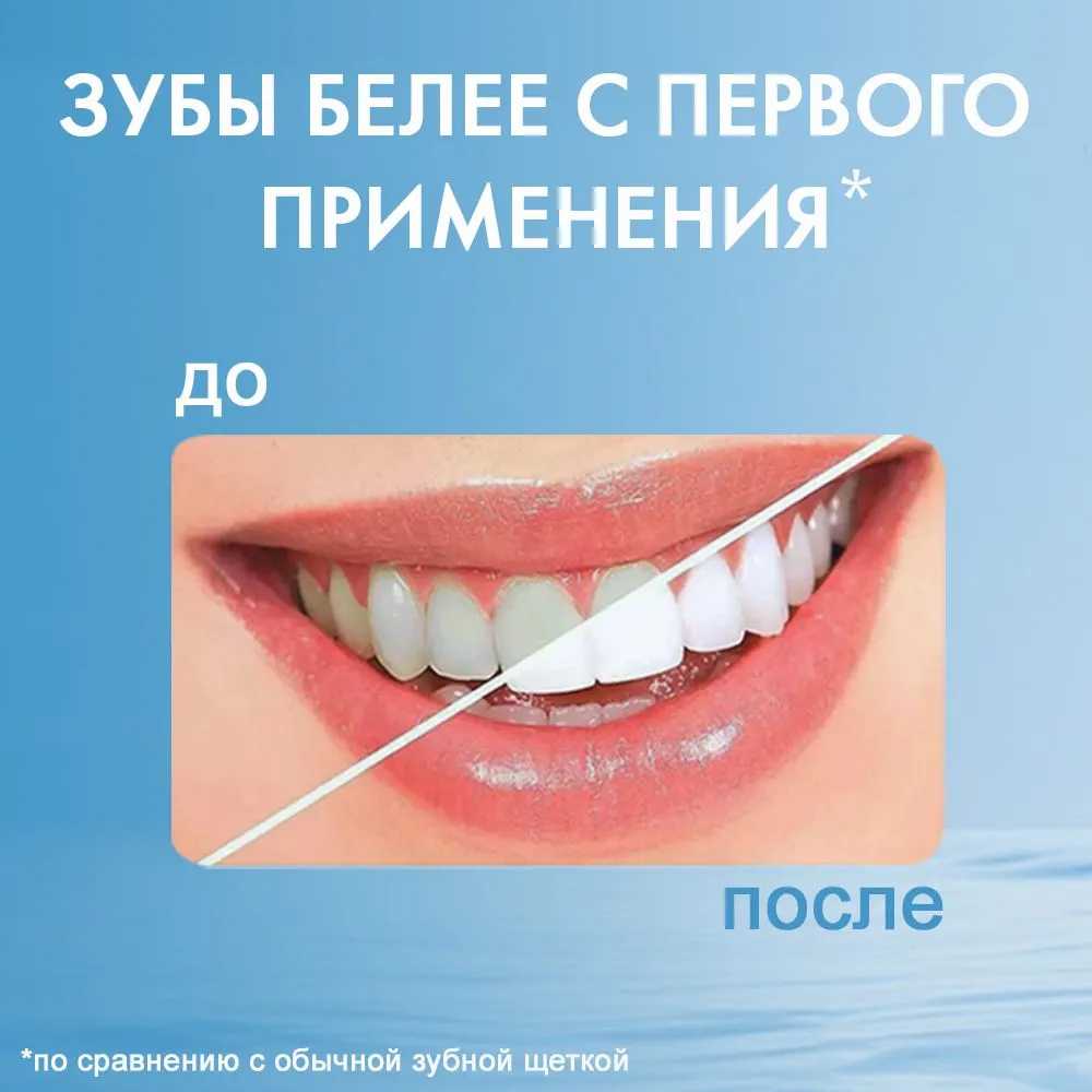 Насадки для зубной щетки Oral-B EB17-P фотография 34