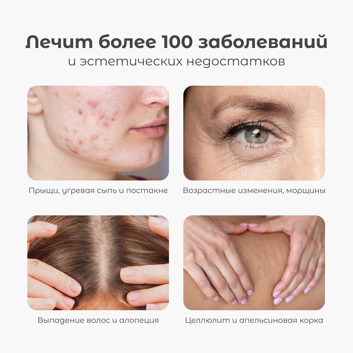 Дарсонваль Gezatone Biolift4 (118) фотография 2